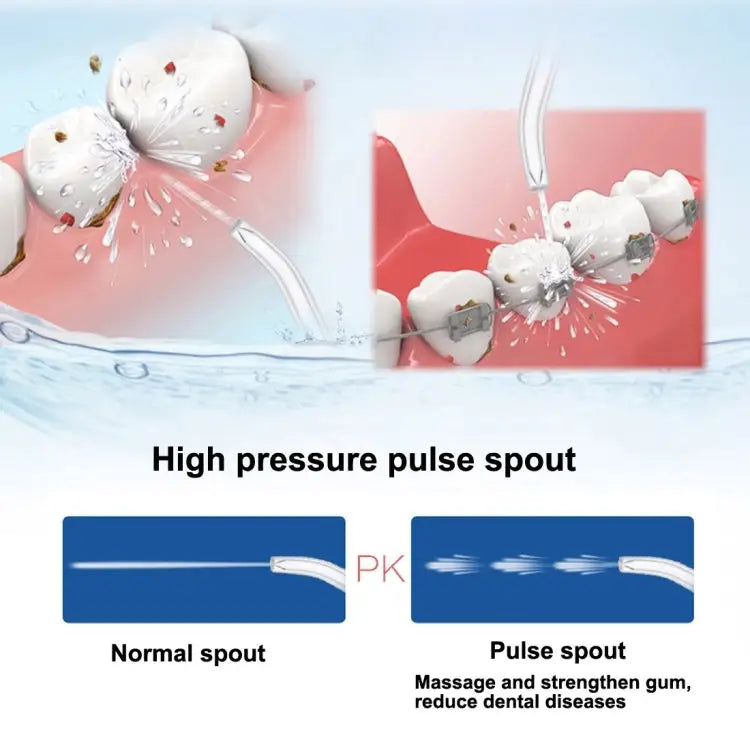 2 PCS 5901 Replacement Nozzles for Prooral 5002 (HC7705) Oral Irrigator For Prooral 5002 - For Prooral 5002