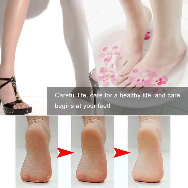 8 in 1 Dead Hard Skin Callus Remover Scraper Pedicure Rasp Tools Portable Cuticle Pusher Nail Foot Care Tool 8 in 1 - 8